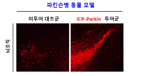 iCP-Parkin 투여 후 파킨슨병 뇌조직에서 회복된 도파민 분비 신경세포(붉은색) 사진 ⓒ 셀리버리