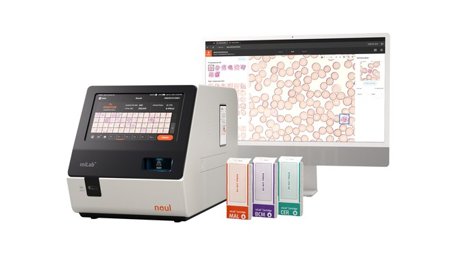 노을의 AI 기반 혈액 및 암 진단 플랫폼 '마이랩' 디바이스와 카트리지. ⓒ 노을