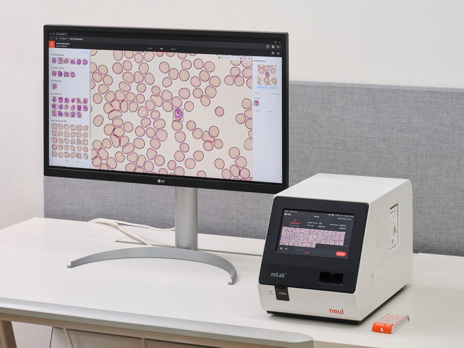 노을의 AI 기반 말라리아 솔루션 '마이랩 MAL'. ⓒ 노을