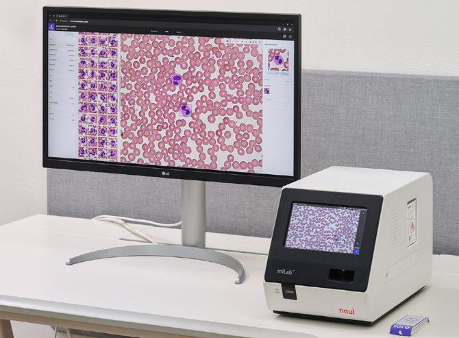 전혈구검사를 통합한 완전 자동화 혈액 분석 솔루션 '마이랩 BCM'. ⓒ 노을