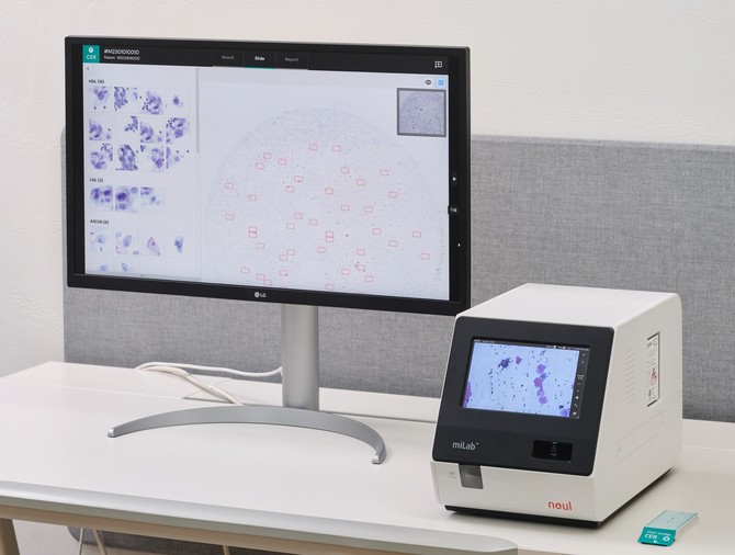 노을의 AI 기반 자궁경부암 진단 솔루션 '마이랩 CER'. ⓒ 노을