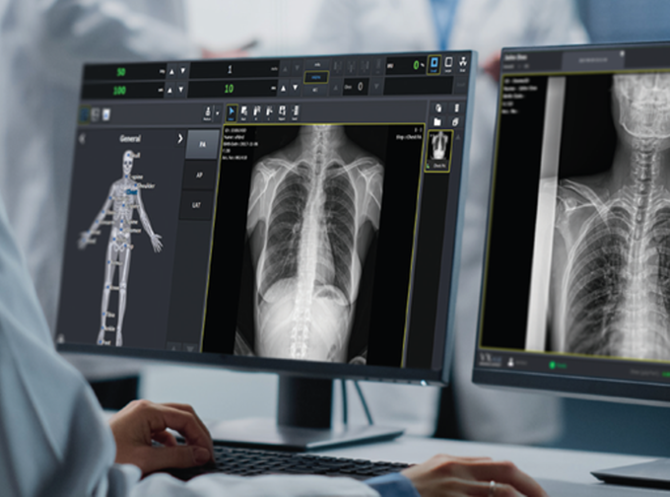 뷰웍스 디지털 의료영상 획득 및 처리 소프트웨어 '브이엑스뷰'. ⓒ 뷰웍스