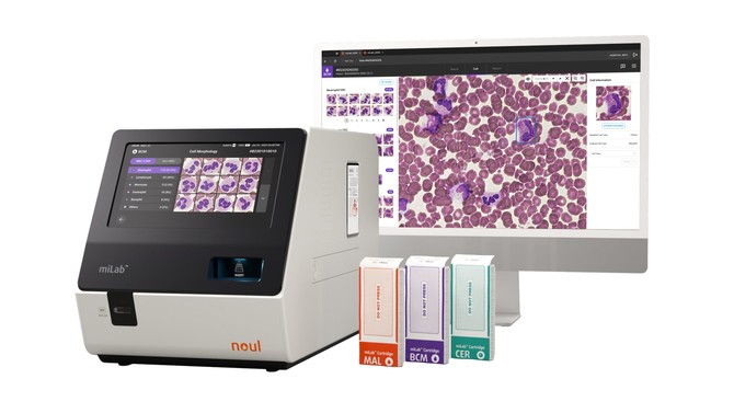 노을 AI 기반 혈액 및 암 진단 플랫폼 '마이랩' 디바이스와 카트리지. ⓒ 노을