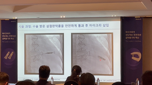 유희태 교수가 발표 중 실제 환자 사례 시술 과정을 담은 화면. = 박선린 기자